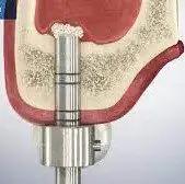 Dentist near me, dentista cerca de mi, best dentist miami, mejor dentista miami, pizza near me, chinese near me, food near me, crown dentist miami, cheapest dentist miami, root canal dentist miami, cheapest root canal miami
